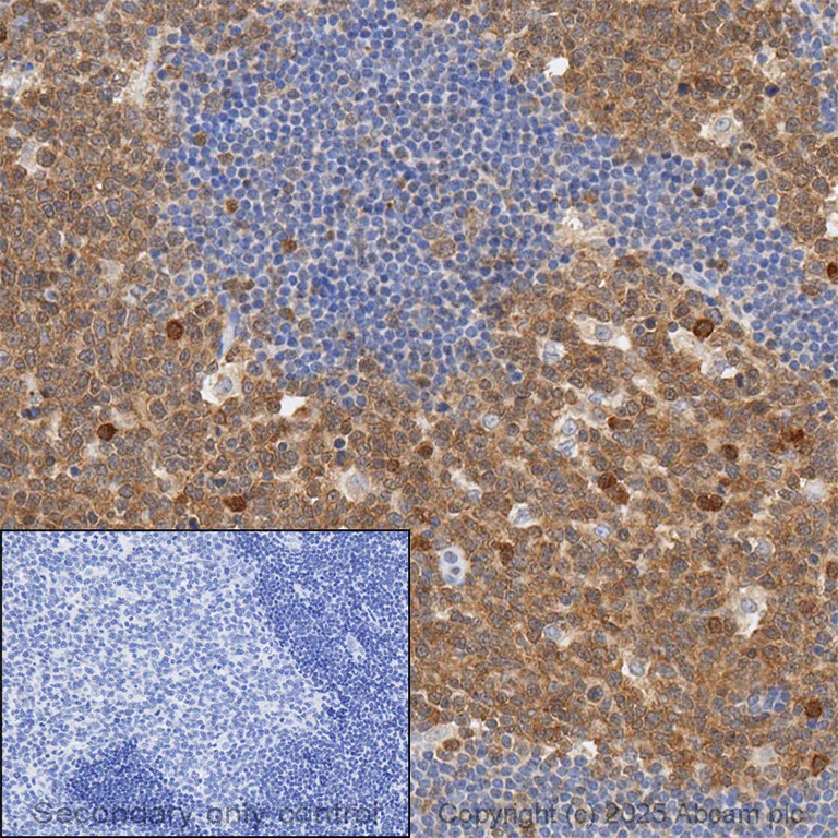 Immunohistochemistry (Formalin/PFA-fixed paraffin-embedded sections) - Anti-Caspase-3 antibody [E87] (AB32351)