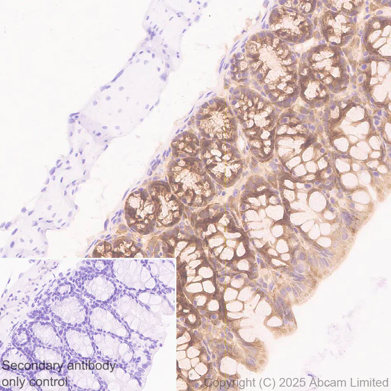 Immunohistochemistry (Formalin/PFA-fixed paraffin-embedded sections) - Anti-Caspase-3 antibody [EPR17664-28] - BSA and Azide free (Detector) (AB281085)