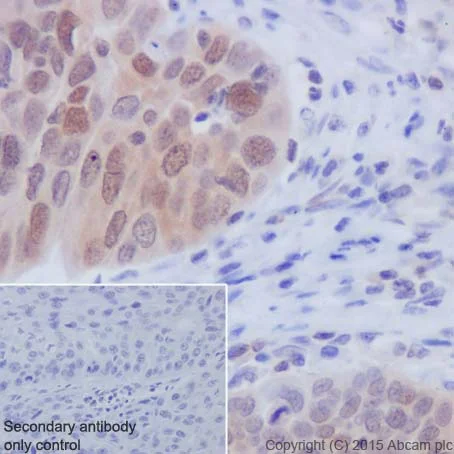 Immunohistochemistry (Formalin/PFA-fixed paraffin-embedded sections) - Anti-Caspase-3 antibody [EPR18297] - BSA and Azide free (AB224271)