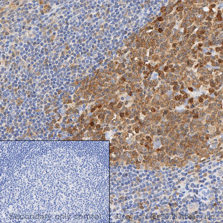 Immunohistochemistry (Formalin/PFA-fixed paraffin-embedded sections) - Anti-Caspase-3 antibody [EPR18297] - BSA and Azide free (AB224271)