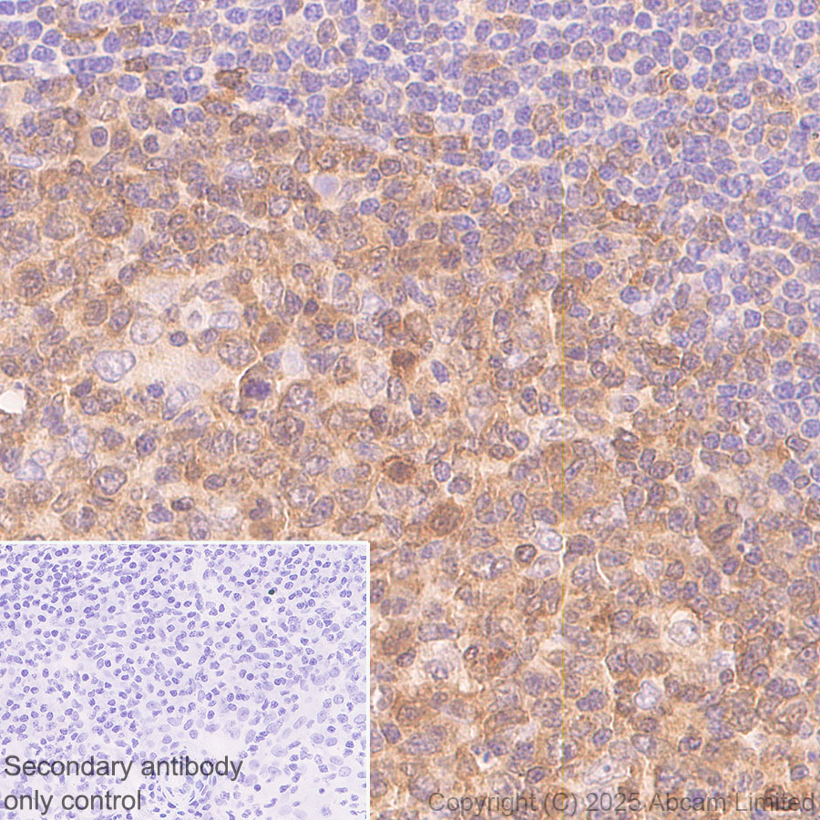 Immunohistochemistry (Formalin/PFA-fixed paraffin-embedded sections) - Anti-Caspase-3 antibody [RM1299] (ab323369), expandable thumbnail