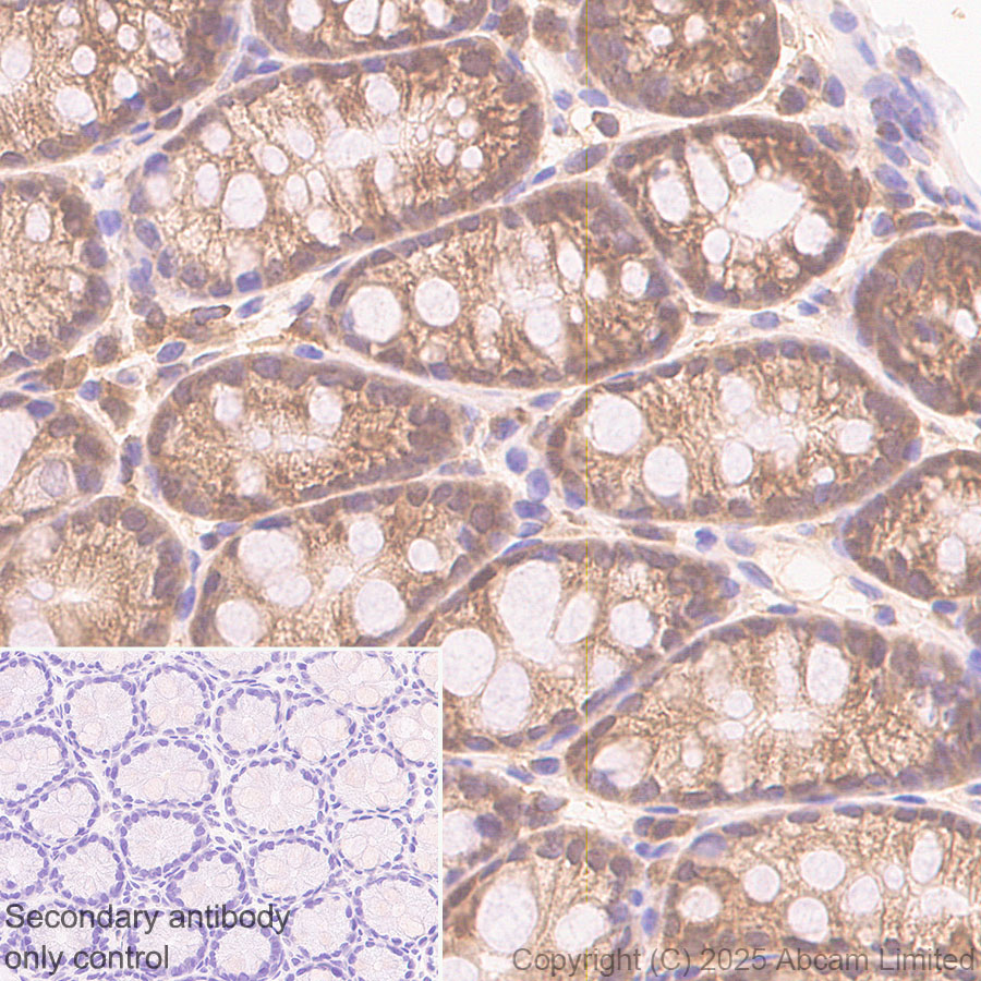 Immunohistochemistry (Formalin/PFA-fixed paraffin-embedded sections) - Anti-Caspase-3 antibody [RM1299] (AB323369), expandable thumbnail