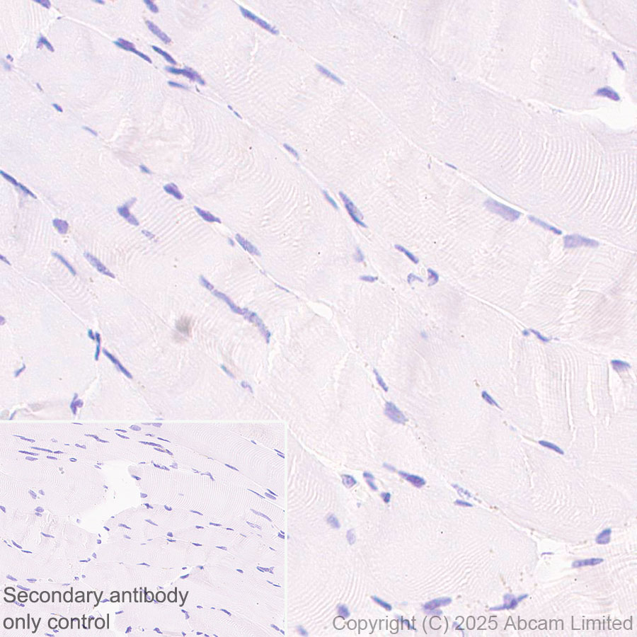 Immunohistochemistry (Formalin/PFA-fixed paraffin-embedded sections) - Anti-Caspase-3 antibody [RM1299] (AB323369), expandable thumbnail
