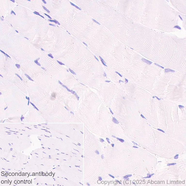 Immunohistochemistry (Formalin/PFA-fixed paraffin-embedded sections) - Anti-Caspase-3 antibody [RM1299] (AB323369)