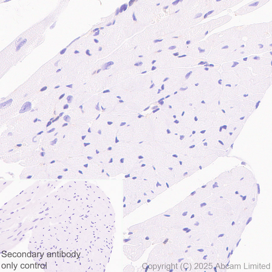Immunohistochemistry (Formalin/PFA-fixed paraffin-embedded sections) - Anti-Caspase-3 antibody [RM1299] (AB323369), expandable thumbnail