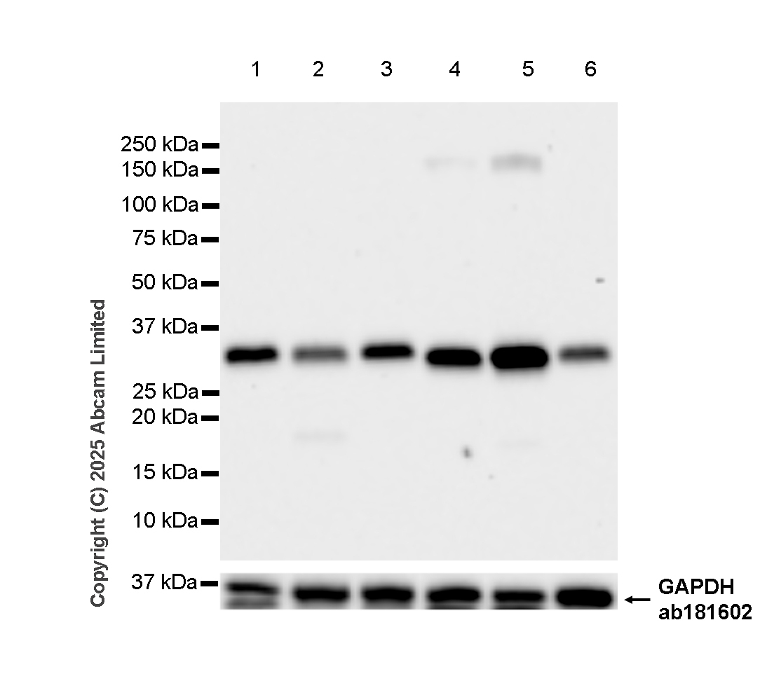Western blot - Anti-Caspase-3 antibody [RM1299] (ab323369), expandable thumbnail