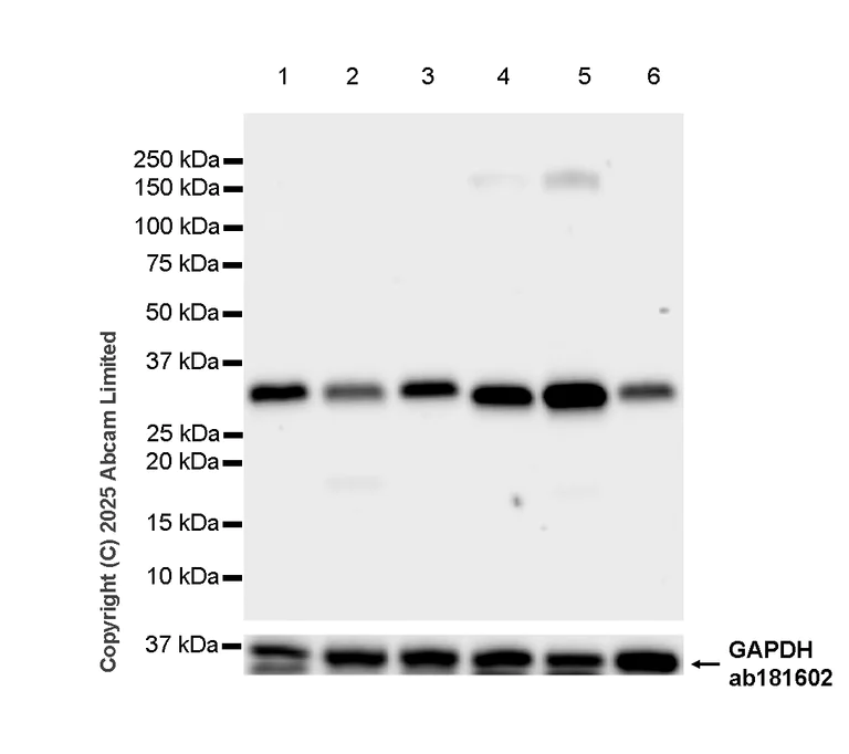 Western blot - Anti-Caspase-3 antibody [RM1299] (AB323369)