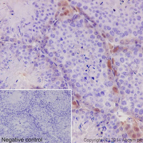 Immunohistochemistry (Formalin/PFA-fixed paraffin-embedded sections) - Anti-Caspase-3 p12 antibody [EPR16888] (AB179517)