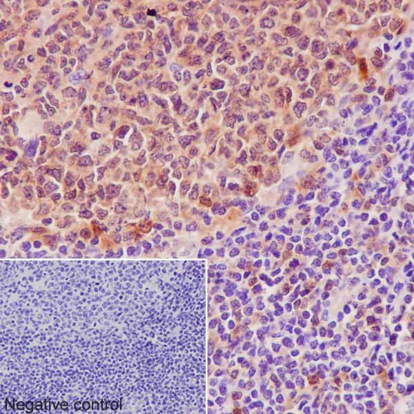 Immunohistochemistry (Formalin/PFA-fixed paraffin-embedded sections) - Anti-Caspase-3 p12 antibody [EPR16888] (AB179517)