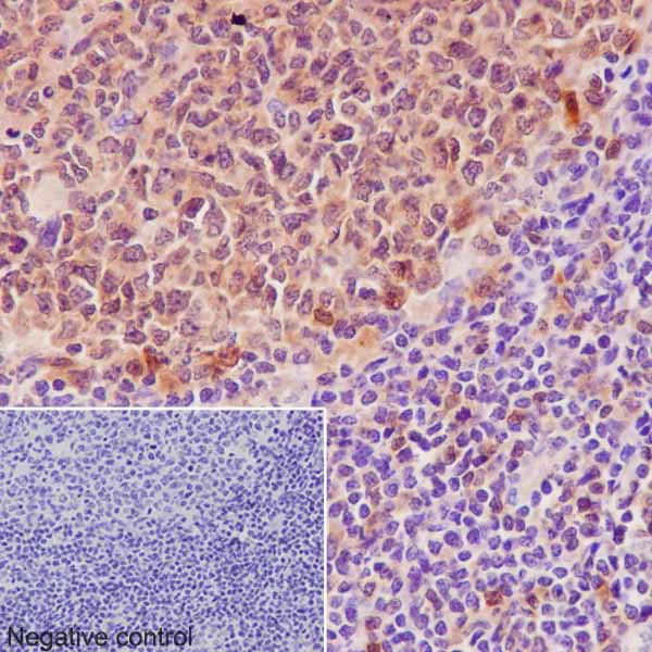 Immunohistochemistry (Formalin/PFA-fixed paraffin-embedded sections) - Anti-Caspase-3 p12 antibody [EPR16888] (AB179517)