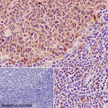 Immunohistochemistry (Formalin/PFA-fixed paraffin-embedded sections) - Anti-Caspase-3 p12 antibody [EPR16888] - BSA and Azide free (AB238936)