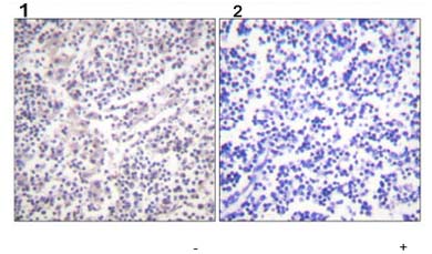 Immunohistochemistry (Formalin/PFA-fixed paraffin-embedded sections) - Anti-Caspase-3 (phospho S150) antibody (AB59425), expandable thumbnail
