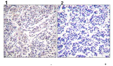 Immunohistochemistry (Formalin/PFA-fixed paraffin-embedded sections) - Anti-Caspase-3 (phospho S150) antibody (AB59425)