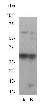 Western blot - Anti-Caspase-6/CASP-6 antibody [E180] (AB32366), expandable thumbnail