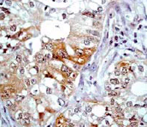 Immunohistochemistry (Formalin/PFA-fixed paraffin-embedded sections) - Anti-Caspase-6/CASP-6 antibody [E180] - BSA and Azide free (AB247249)