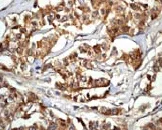 Immunohistochemistry (Formalin/PFA-fixed paraffin-embedded sections) - Anti-Caspase-6/CASP-6 antibody [EP1325Y] - BSA and Azide free (AB247343)