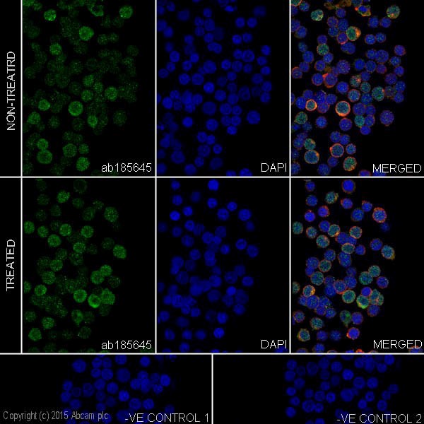 Immunocytochemistry/ Immunofluorescence - Anti-Caspase-6/CASP-6 antibody [EPR18043] (AB185645)