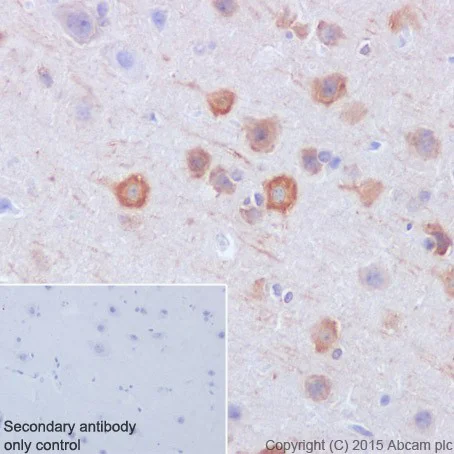Immunohistochemistry (Formalin/PFA-fixed paraffin-embedded sections) - Anti-Caspase-6/CASP-6 antibody [EPR18043] (AB185645)