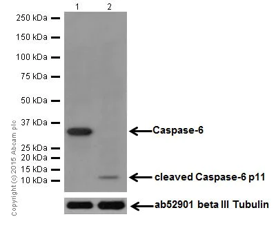 Western blot - Anti-Caspase-6/CASP-6 antibody [EPR18043] (AB185645)