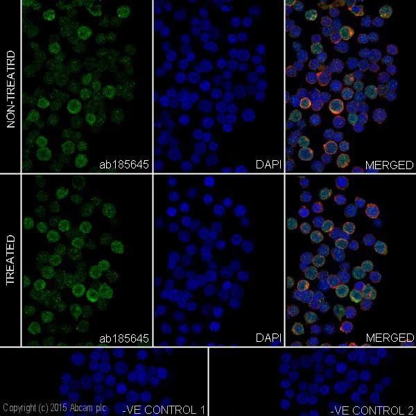Immunocytochemistry/ Immunofluorescence - Anti-Caspase-6/CASP-6 antibody [EPR18043] - BSA and Azide free (AB240296)