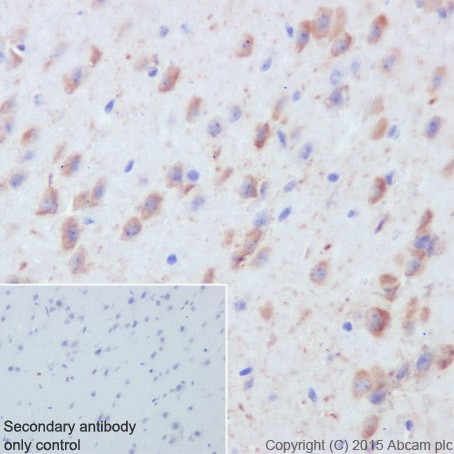 Immunohistochemistry (Formalin/PFA-fixed paraffin-embedded sections) - Anti-Caspase-6/CASP-6 antibody [EPR18043] - BSA and Azide free (AB240296), expandable thumbnail
