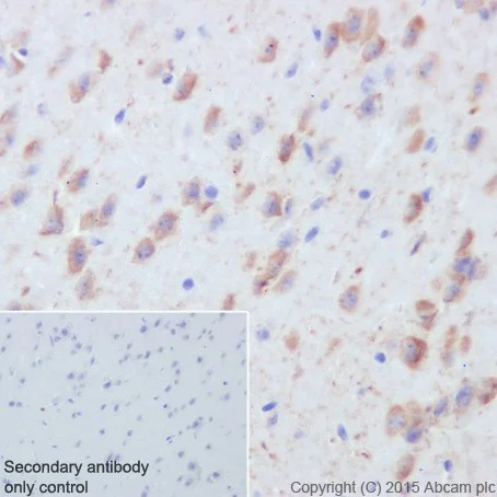 Immunohistochemistry (Formalin/PFA-fixed paraffin-embedded sections) - Anti-Caspase-6/CASP-6 antibody [EPR18043] - BSA and Azide free (AB240296)