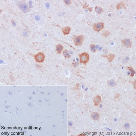 Immunohistochemistry (Formalin/PFA-fixed paraffin-embedded sections) - Anti-Caspase-6/CASP-6 antibody [EPR18043] - BSA and Azide free (AB240296), expandable thumbnail