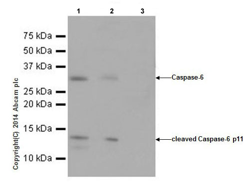 Immunoprecipitation - Anti-Caspase-6/CASP-6 antibody [EPR18043] - BSA and Azide free (AB240296), expandable thumbnail