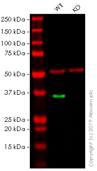 Anti-Caspase-6/CASP-6 antibody [EPR4405]