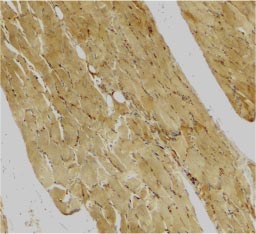 Immunohistochemistry (Formalin/PFA-fixed paraffin-embedded sections) - Anti-Caspase-7 antibody (AB25900)