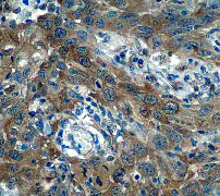 Immunohistochemistry (Formalin/PFA-fixed paraffin-embedded sections) - Anti-Caspase-7 antibody [E22] - BSA and Azide free (AB284673)