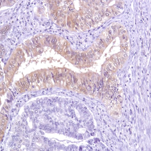 Immunohistochemistry (Formalin/PFA-fixed paraffin-embedded sections) - Anti-Caspase-7 antibody [SP284] - C-terminal (AB226763)