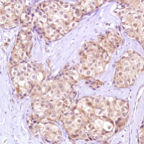 Immunohistochemistry (Formalin/PFA-fixed paraffin-embedded sections) - Anti-Caspase-7 antibody [SP284] - C-terminal (AB226763)