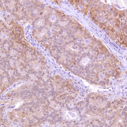 Immunohistochemistry (Formalin/PFA-fixed paraffin-embedded sections) - Anti-Caspase-7 antibody [SP284] - C-terminal (AB226763)