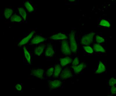 Immunocytochemistry/ Immunofluorescence - Anti-Caspase-8 antibody (AB231948), expandable thumbnail