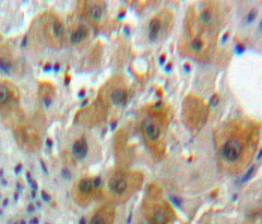 Immunohistochemistry (Formalin/PFA-fixed paraffin-embedded sections) - Anti-Caspase-8 antibody (AB231948), expandable thumbnail