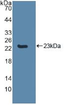 Western blot - Anti-Caspase-8 antibody (AB231948), expandable thumbnail