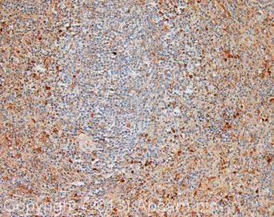 Immunohistochemistry (Formalin/PFA-fixed paraffin-embedded sections) - Anti-Caspase-8 antibody (AB25901), expandable thumbnail