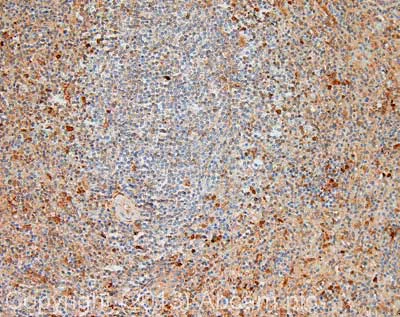 Immunohistochemistry (Formalin/PFA-fixed paraffin-embedded sections) - Anti-Caspase-8 antibody (AB25901)
