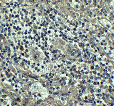 Immunohistochemistry (Formalin/PFA-fixed paraffin-embedded sections) - Anti-Caspase-8 antibody (AB25901)