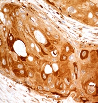 Immunohistochemistry (Formalin/PFA-fixed paraffin-embedded sections) - Anti-Caspase-8 antibody [ABM14C1] (AB220171), expandable thumbnail