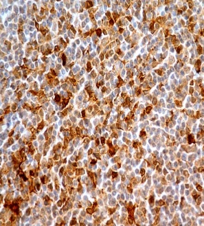 Immunohistochemistry (Formalin/PFA-fixed paraffin-embedded sections) - Anti-Caspase-8 antibody [ABM14C1] (AB220171), expandable thumbnail