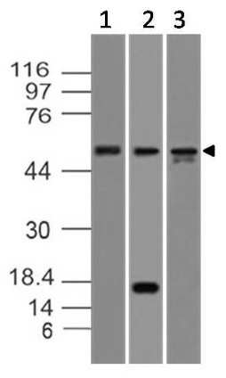 Western blot - Anti-Caspase-8 antibody [ABM14C1] (AB220171), expandable thumbnail