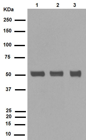 Western blot - Anti-Caspase-8 antibody [E7] (AB32397), expandable thumbnail