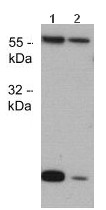 Western blot - Anti-Caspase-8 antibody [M382] (AB119809), expandable thumbnail