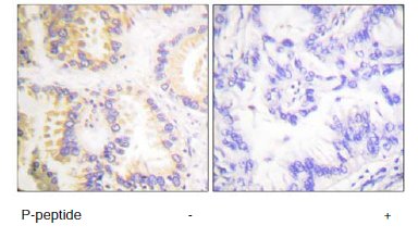 Immunohistochemistry (Formalin/PFA-fixed paraffin-embedded sections) - Anti-Caspase-8 (phospho S347) antibody (AB61755), expandable thumbnail