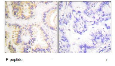 Immunohistochemistry (Formalin/PFA-fixed paraffin-embedded sections) - Anti-Caspase-8 (phospho S347) antibody (AB61755)