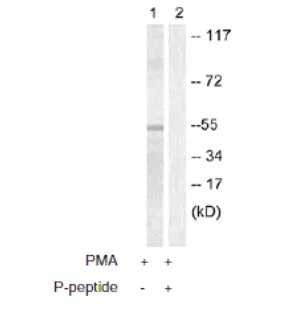 Western blot - Anti-Caspase-8 (phospho S347) antibody (AB61755)