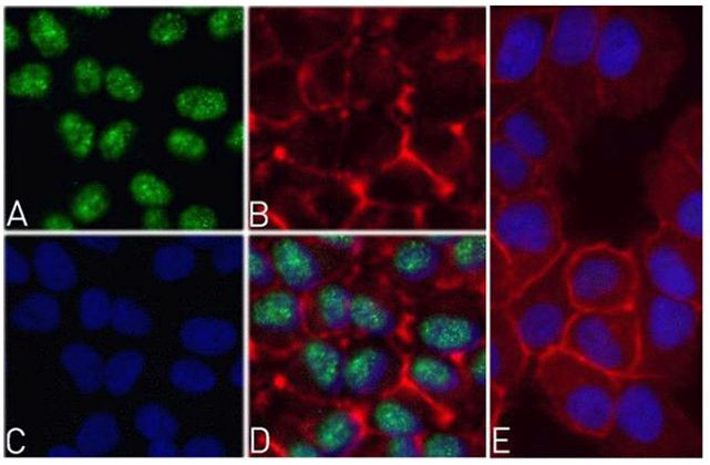 Immunocytochemistry/ Immunofluorescence - Anti-Caspase 8 (phospho S387) antibody [RP23040092] (AB308013)