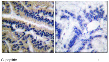 Immunohistochemistry (Formalin/PFA-fixed paraffin-embedded sections) - Anti-Caspase-9 antibody (AB52298)